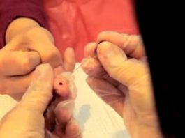 4 Pros and Cons of Donating Blood